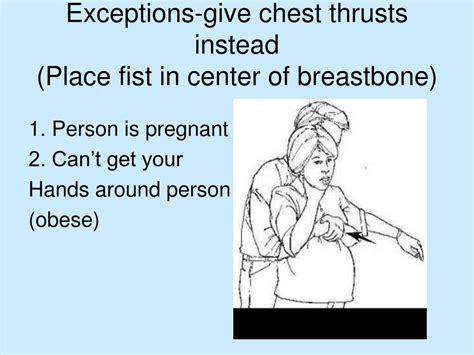 Search for a product or brand. . What are some examples of a patient for whom chest thrusts